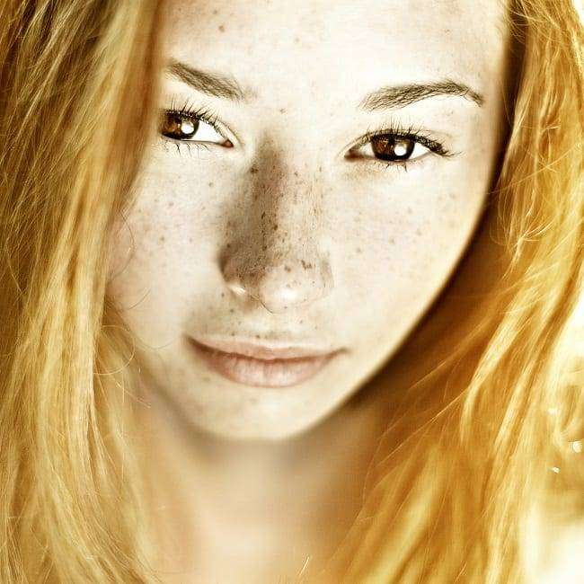 woman with freckled