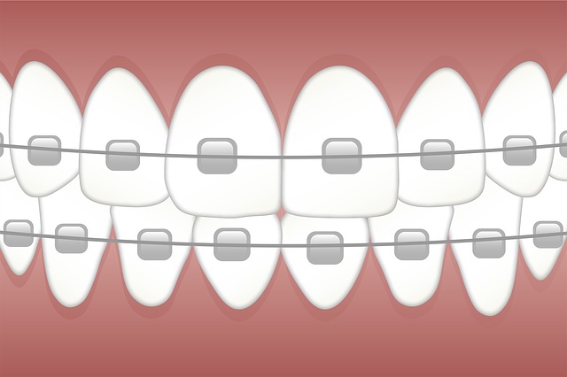 aparaty ortodontyczne 