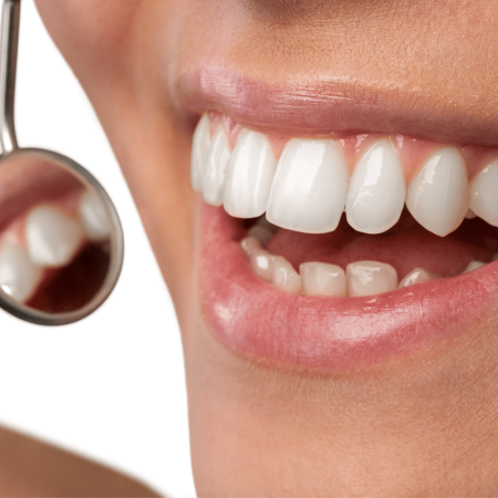 Wypełnienia estetyczne – zdrowie i piękno zębów